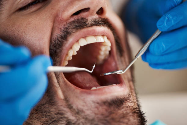 Best Emergency Wisdom Tooth Extraction in Waimalu, HI